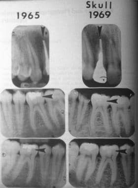 Forensic dentistry (forensic odontology). These ph