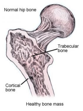 Trabecular and cancellous bone. 