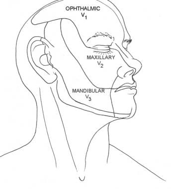 Distribution of cranial nerve V. Illustrated by Ch