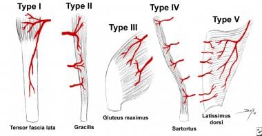 Tissue Flap Classification Classification And Principles Of