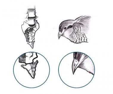 Coccyx as compared with cuckoo's beak. 