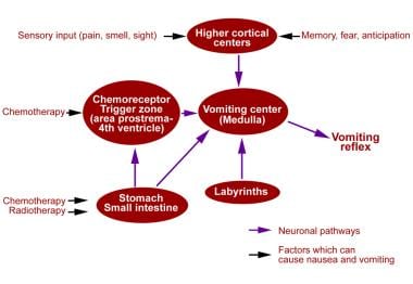 Why Chemotherapy May Cause Nausea and Vomiting