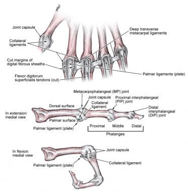 Metacarpophalangeal ligaments. 