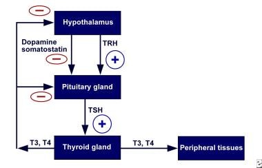 Pediatric Hyperthyroidism. Schematic representatio