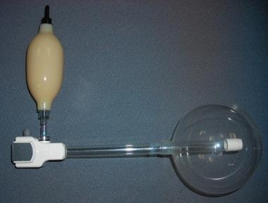 A retroperitoneal balloon access device, inflated 