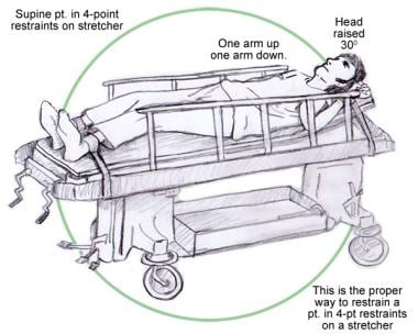 extremity restraints