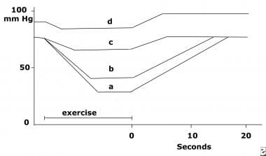 Hemodynamic charting of (a) healthy patients, (b) 