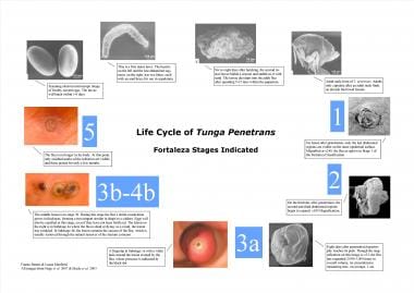 Life cycle of Tunga penetrans - Fortaleza stages i