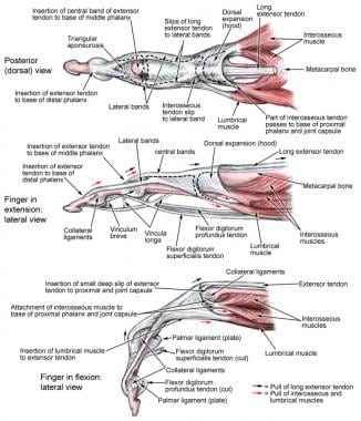 Metacarpophalangeal musculoskeletal structure. 