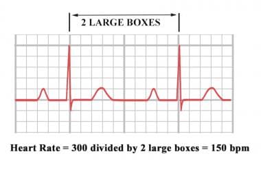 Heart rate boxes.