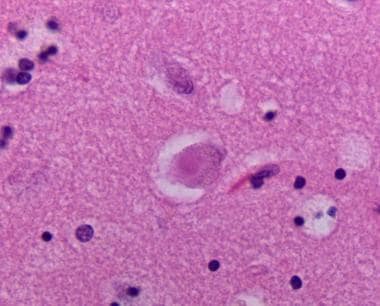 Hematoxylin and eosin stained section of neocortex