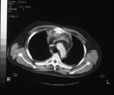 Contrast-enhanced computed tomography scan through