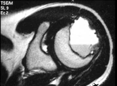 Axial T2-weighted magnetic resonance image of a hu