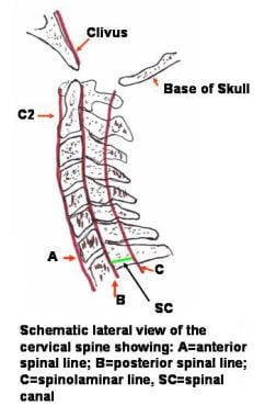 Neck condition: a) neck extension; b) normal; c) neck flexion [4].