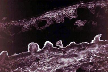 Indirect immunofluorescence performed on salt-spli