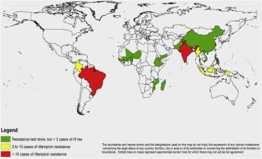 Map of countries reporting rifampicin resistance i