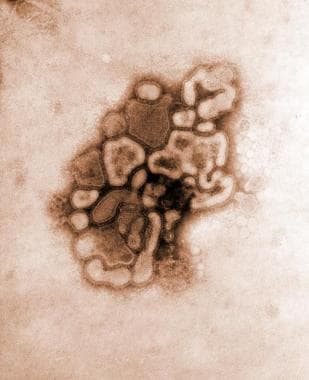 h1n1 influenza virus