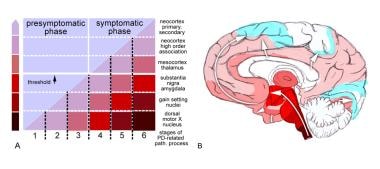 Stages in the development of Parkinson disease (PD