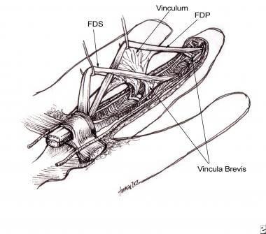 hand anatomy flexor tendons