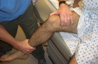 Reduction of Patellar Dislocation Periprocedural Care Patient