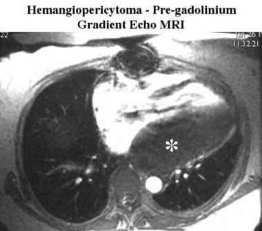 Pregadolinium gradient-echo MRI scan of a patient 