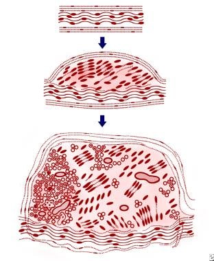 A schematic illustration of the essential microsco