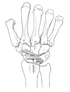 (Click image to enlarge.) Dorsal carpal ligaments.