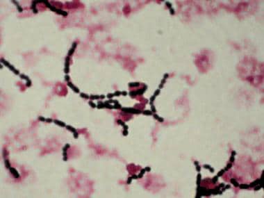 Group A Streptococcus on Gram stain of blood isola