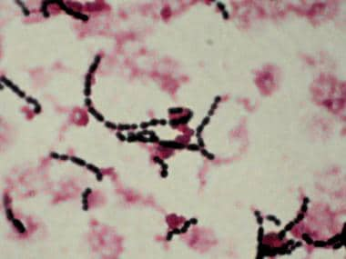 streptococcus gram stain