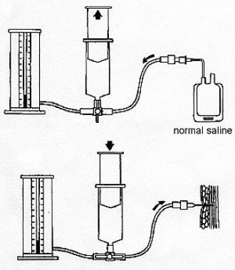 Compartment Pressure Testing