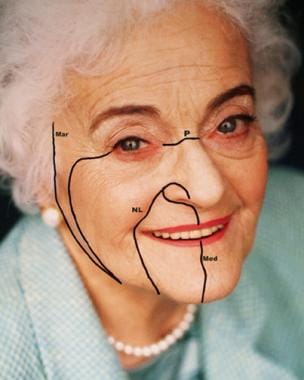 Four main facial lines show the direction of relax