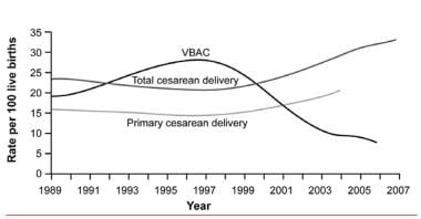 C - section - Cesarean delivery in live (Full) 