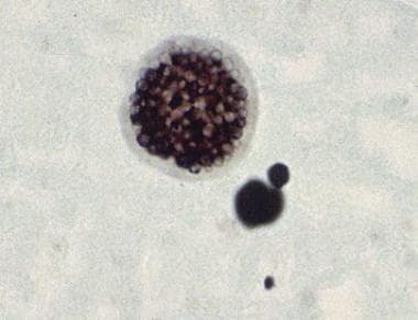 A Coccidioides immitis spherule containing endospo