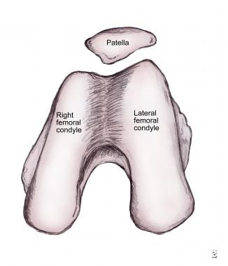 Anatomic morphology of patellar insertion into the