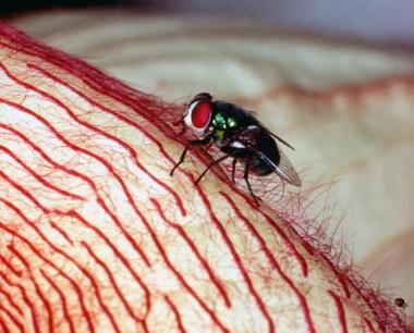 9 (Left) The compound eyes of the blue bottle fly. (Right) Each of