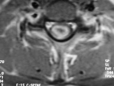 Axial T1-weighted contrast-enhanced magnetic reson