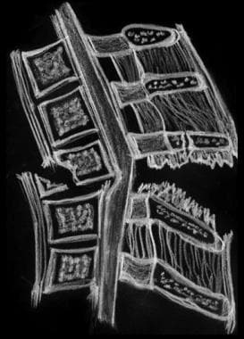 Illustration of the cervical spine (side view) sho