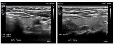 The panels show a transverse and longitudinal (sag