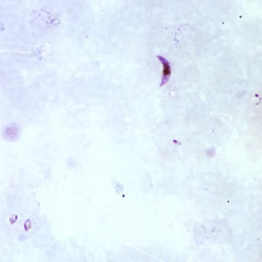 Thick blood smear depicting the banana shaped game