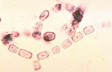 Arthroconidia become airborne and infect the human