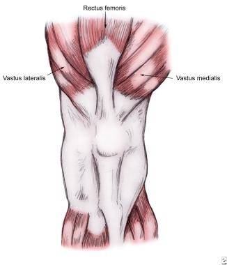 Patellar Injury and Dislocation: Background, Epidemiology, Functional  Anatomy