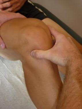 Palpation for joint line tenderness. 