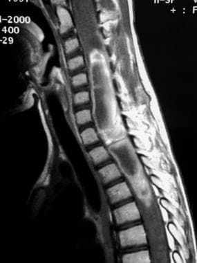 Sagittal T1-weighted contrast-enhanced magnetic re