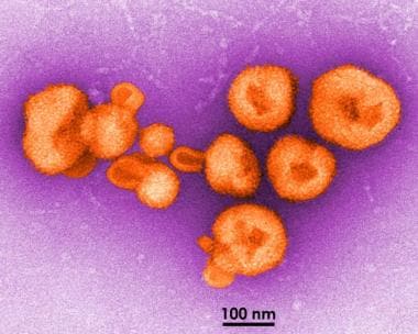 Transmission electron microscopic (TEM) image depi