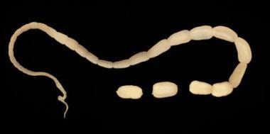 Adult tapeworm of Dipylidium caninum. Image courte