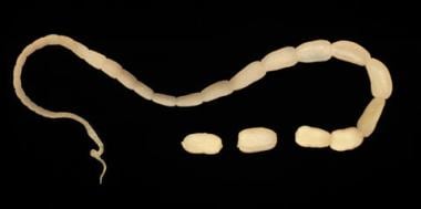 tapeworms in humans