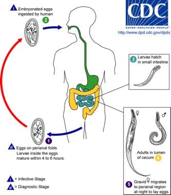 Incidence of enterobiasis Incidence of enterobiasis