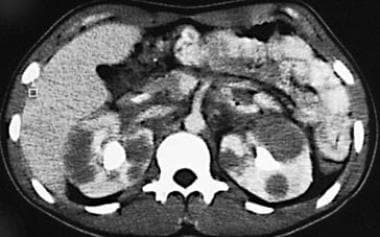 Contrast-enhanced computed tomography (CT) scan ob