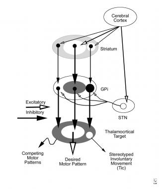 Tourette syndrome and other tic disorders. Schemat