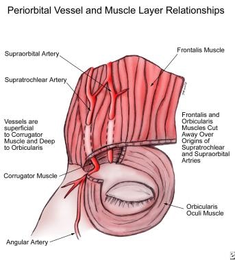 The anatomic relationship of the supratrochlear ve
